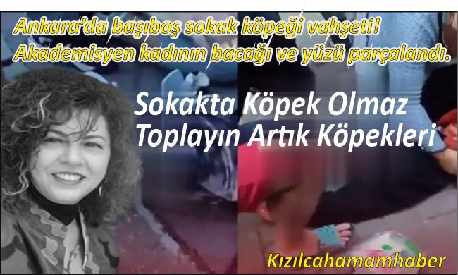 Ankara'da başıboş sokak köpeği vahşeti! Profesör kadının bacağı ve yüzü parçalandı